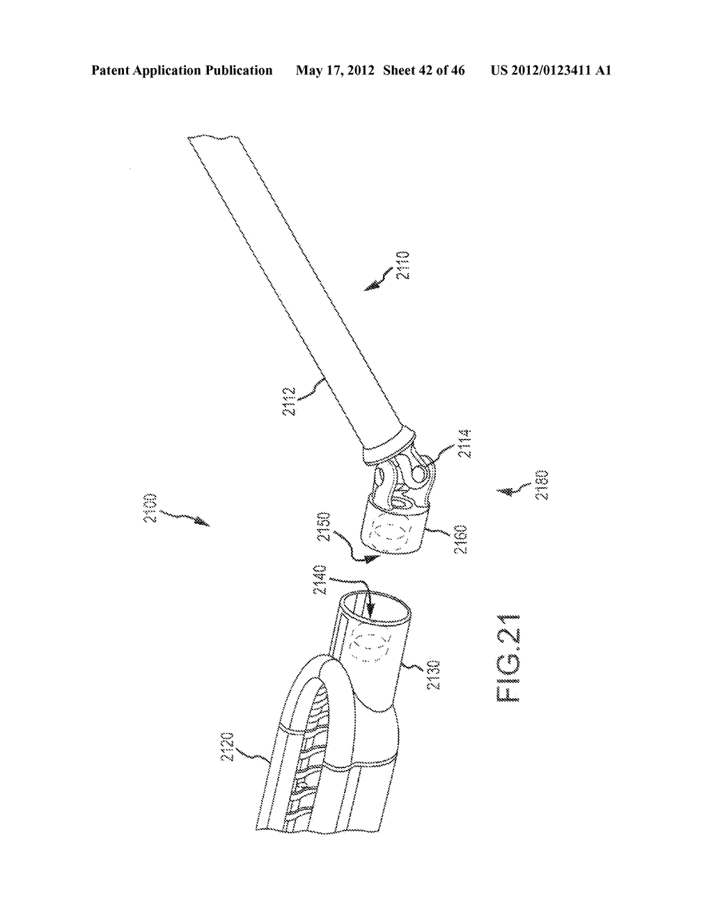 STABILIZED ABLATION SYSTEMS AND METHODS - diagram, schematic, and image 43