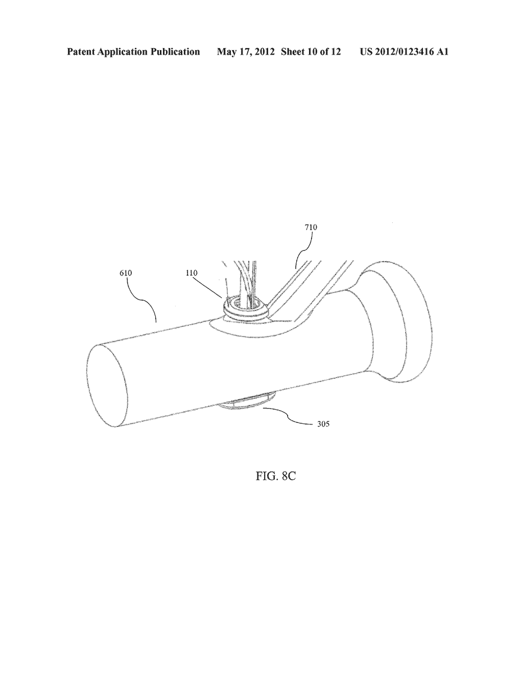 METHODS AND DEVICES FOR SOFT TISSUE AND JOINT REPAIR - diagram, schematic, and image 11