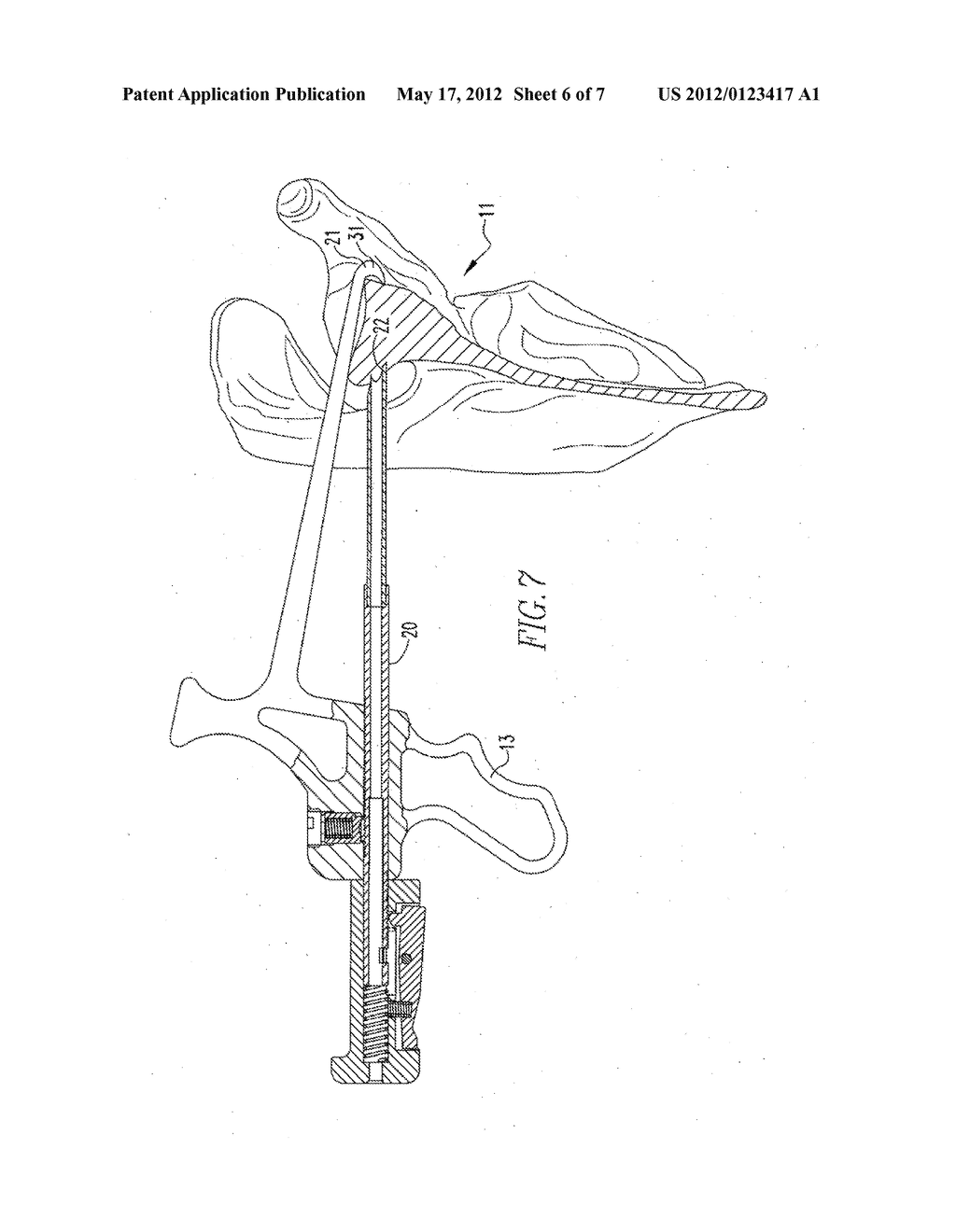 Drill Guide with Depth Stop - diagram, schematic, and image 07