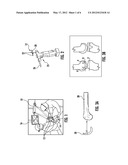 STABILIZERS FOR SURGICAL TOOLS diagram and image