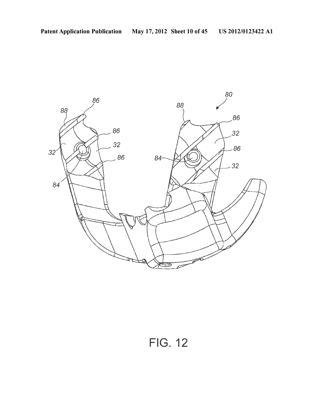 Patient-Matched Instruments - diagram, schematic, and image 11