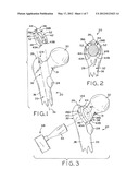 PATIENT-SPECIFIC INSTRUMENTS FOR TOTAL HIP ARTHROPLASTY diagram and image