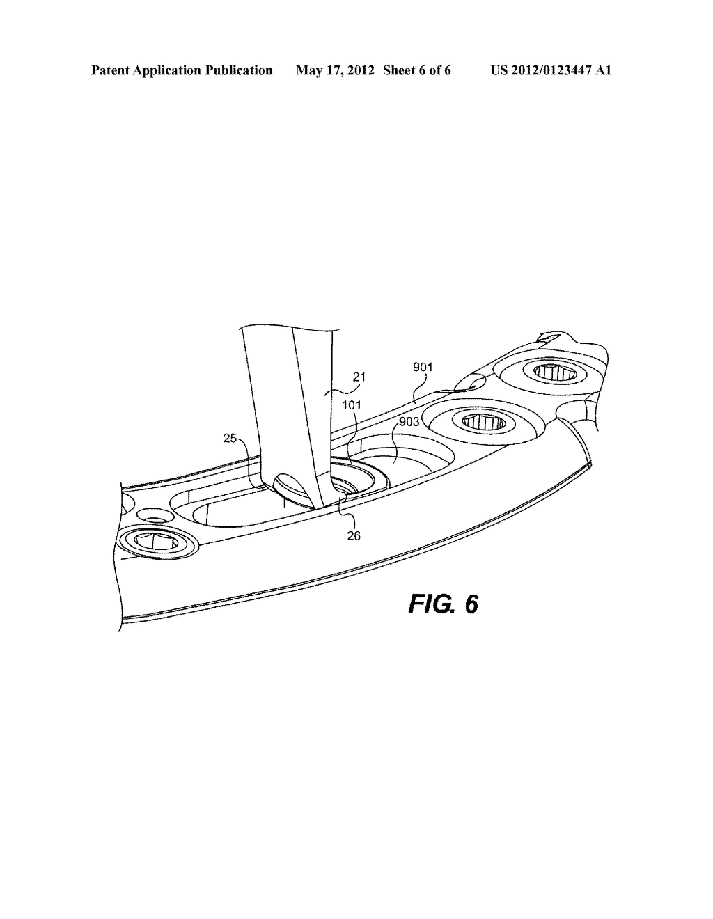 DEVICE FOR TENSIONING FLEXIBLE MATERIAL - diagram, schematic, and image 07