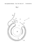 FASTENING DEVICE, IMPLANT DEVICE, LOCKING METHOD, AND OPERATION METHOD diagram and image