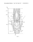 SUTURELESS VASCULAR ANASTOMOSIS CONNECTION diagram and image