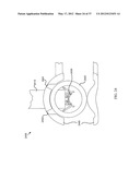 SUTURELESS VASCULAR ANASTOMOSIS CONNECTION diagram and image