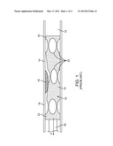 AXIALLY VARIABLE RADIAL PRESSURE CAGES FOR CLOT CAPTURE diagram and image