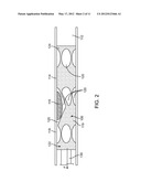 AXIALLY VARIABLE RADIAL PRESSURE CAGES FOR CLOT CAPTURE diagram and image