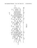 AXIALLY VARIABLE RADIAL PRESSURE CAGES FOR CLOT CAPTURE diagram and image