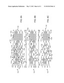 AXIALLY VARIABLE RADIAL PRESSURE CAGES FOR CLOT CAPTURE diagram and image