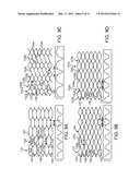 AXIALLY VARIABLE RADIAL PRESSURE CAGES FOR CLOT CAPTURE diagram and image