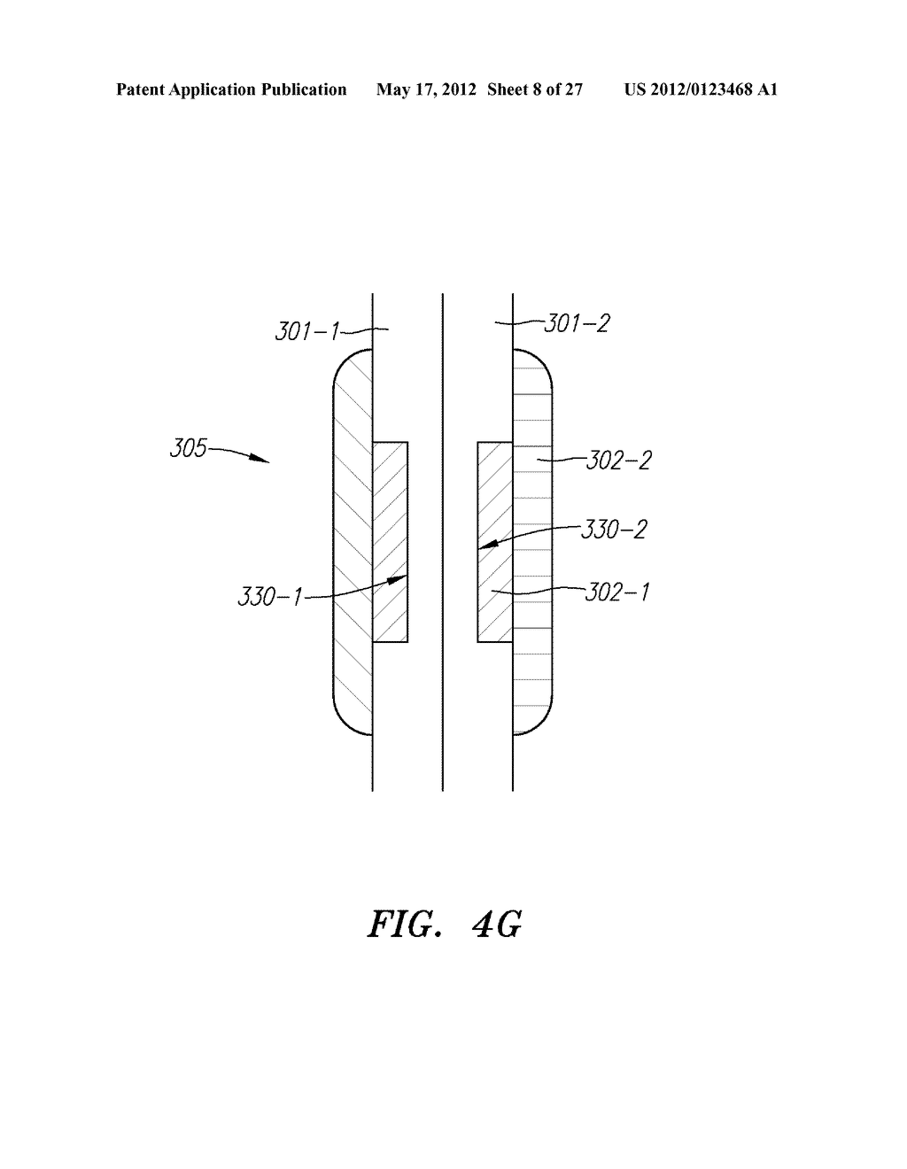 Wire-Like and Other Devices for Treating Septal Defects and Systems and     Methods for Delivering the Same - diagram, schematic, and image 09