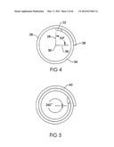 SURGICAL COILS AND METHODS OF DEPLOYING diagram and image