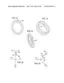 SURGICAL COILS AND METHODS OF DEPLOYING diagram and image