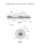 SURGICAL COILS AND METHODS OF DEPLOYING diagram and image