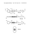 SURGICAL COILS AND METHODS OF DEPLOYING diagram and image