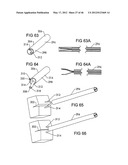 SURGICAL COILS AND METHODS OF DEPLOYING diagram and image