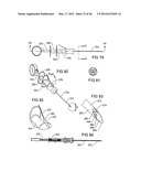 SURGICAL COILS AND METHODS OF DEPLOYING diagram and image