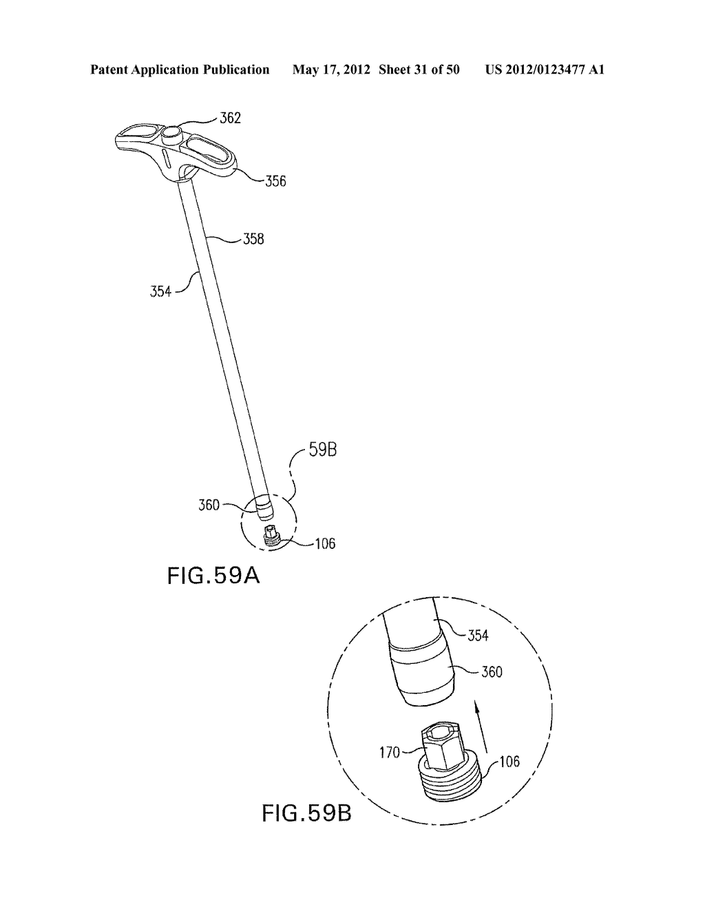 SPINAL STABILIZATION SYSTEMS AND METHODS - diagram, schematic, and image 32