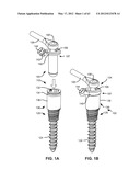 LOW PROFILE SPINAL PROSTHESIS INCORPORATING A BONE ANCHOR HAVING A     DEFLECTABLE POST AND A COMPOUND SPINAL ROD diagram and image