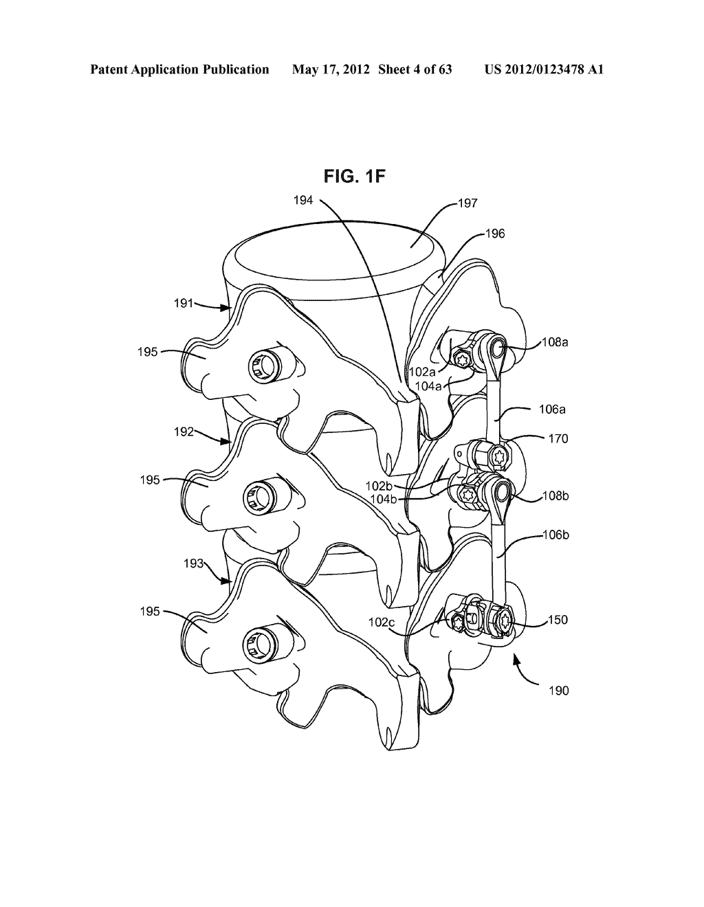 LOW PROFILE SPINAL PROSTHESIS INCORPORATING A BONE ANCHOR HAVING A     DEFLECTABLE POST AND A COMPOUND SPINAL ROD - diagram, schematic, and image 05