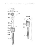 LOW PROFILE SPINAL PROSTHESIS INCORPORATING A BONE ANCHOR HAVING A     DEFLECTABLE POST AND A COMPOUND SPINAL ROD diagram and image