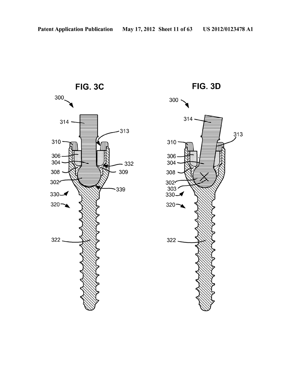 LOW PROFILE SPINAL PROSTHESIS INCORPORATING A BONE ANCHOR HAVING A     DEFLECTABLE POST AND A COMPOUND SPINAL ROD - diagram, schematic, and image 12