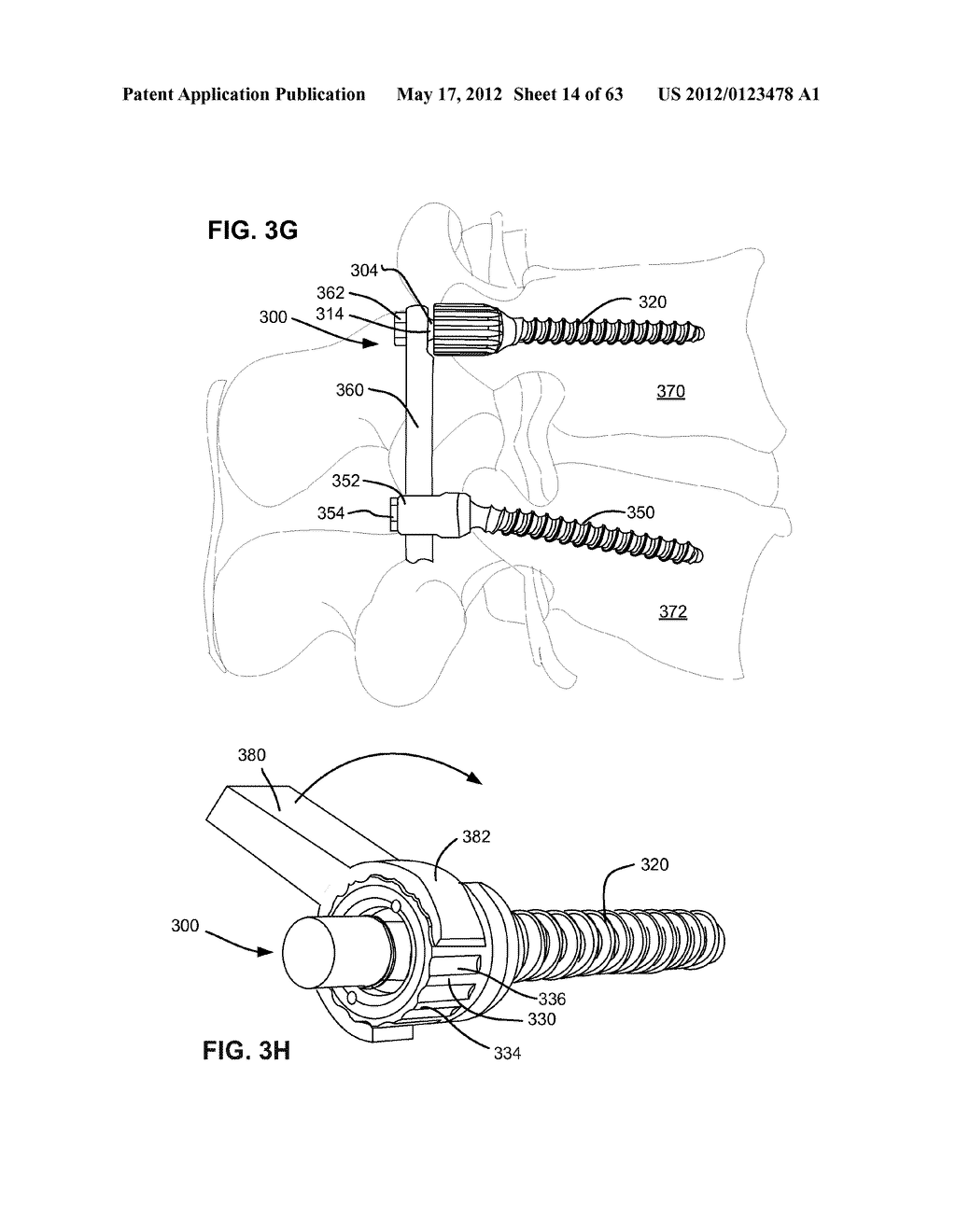 LOW PROFILE SPINAL PROSTHESIS INCORPORATING A BONE ANCHOR HAVING A     DEFLECTABLE POST AND A COMPOUND SPINAL ROD - diagram, schematic, and image 15