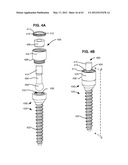 LOW PROFILE SPINAL PROSTHESIS INCORPORATING A BONE ANCHOR HAVING A     DEFLECTABLE POST AND A COMPOUND SPINAL ROD diagram and image