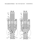 LOW PROFILE SPINAL PROSTHESIS INCORPORATING A BONE ANCHOR HAVING A     DEFLECTABLE POST AND A COMPOUND SPINAL ROD diagram and image