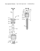 LOW PROFILE SPINAL PROSTHESIS INCORPORATING A BONE ANCHOR HAVING A     DEFLECTABLE POST AND A COMPOUND SPINAL ROD diagram and image