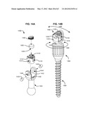 LOW PROFILE SPINAL PROSTHESIS INCORPORATING A BONE ANCHOR HAVING A     DEFLECTABLE POST AND A COMPOUND SPINAL ROD diagram and image