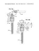 LOW PROFILE SPINAL PROSTHESIS INCORPORATING A BONE ANCHOR HAVING A     DEFLECTABLE POST AND A COMPOUND SPINAL ROD diagram and image