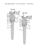 LOW PROFILE SPINAL PROSTHESIS INCORPORATING A BONE ANCHOR HAVING A     DEFLECTABLE POST AND A COMPOUND SPINAL ROD diagram and image