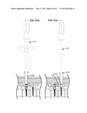 LOW PROFILE SPINAL PROSTHESIS INCORPORATING A BONE ANCHOR HAVING A     DEFLECTABLE POST AND A COMPOUND SPINAL ROD diagram and image