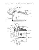 LOW PROFILE SPINAL PROSTHESIS INCORPORATING A BONE ANCHOR HAVING A     DEFLECTABLE POST AND A COMPOUND SPINAL ROD diagram and image