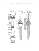 LOW PROFILE SPINAL PROSTHESIS INCORPORATING A BONE ANCHOR HAVING A     DEFLECTABLE POST AND A COMPOUND SPINAL ROD diagram and image