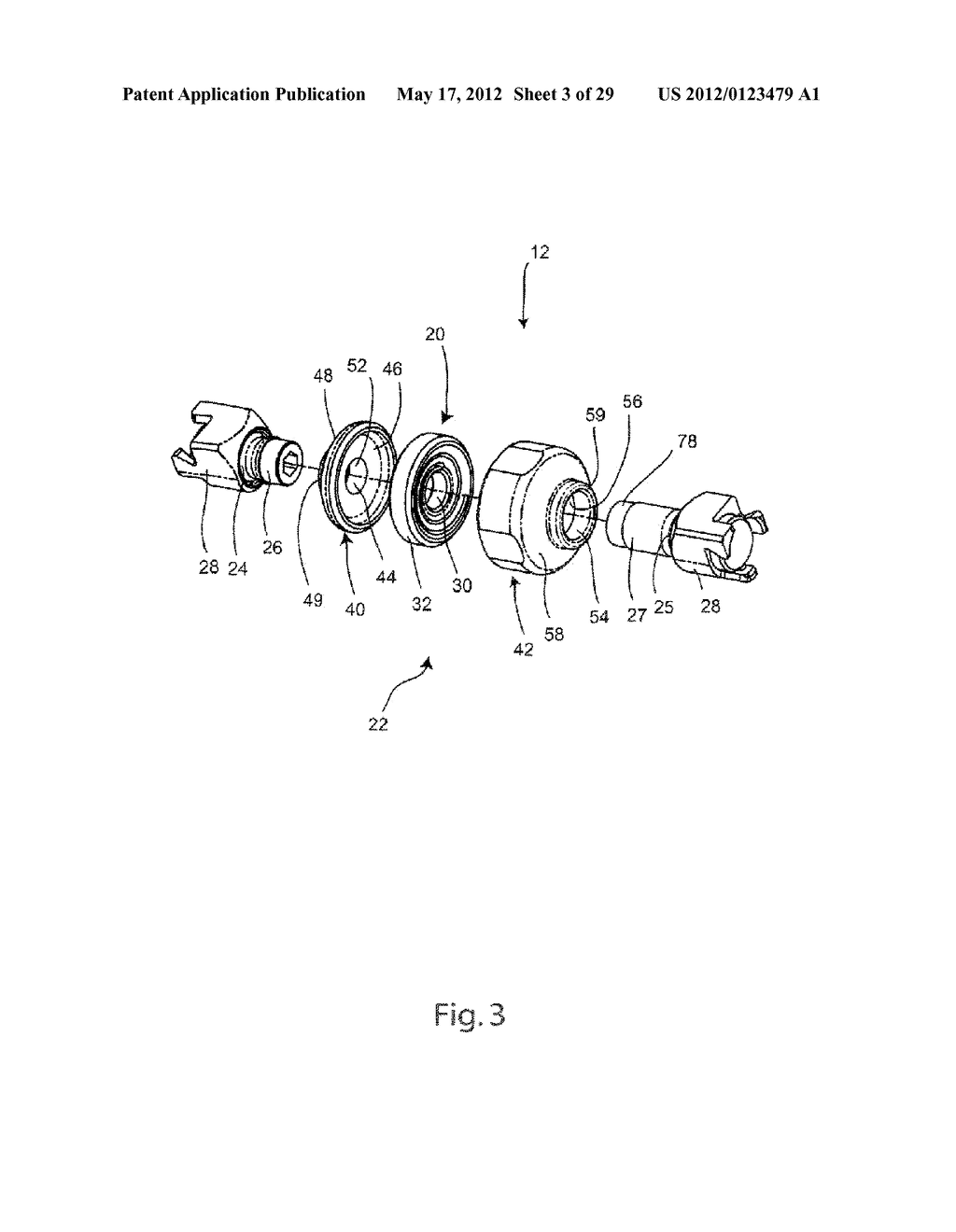 SYSTEM AND METHOD FOR DYNAMIC VERTEBRAL STABILIZATION - diagram, schematic, and image 04