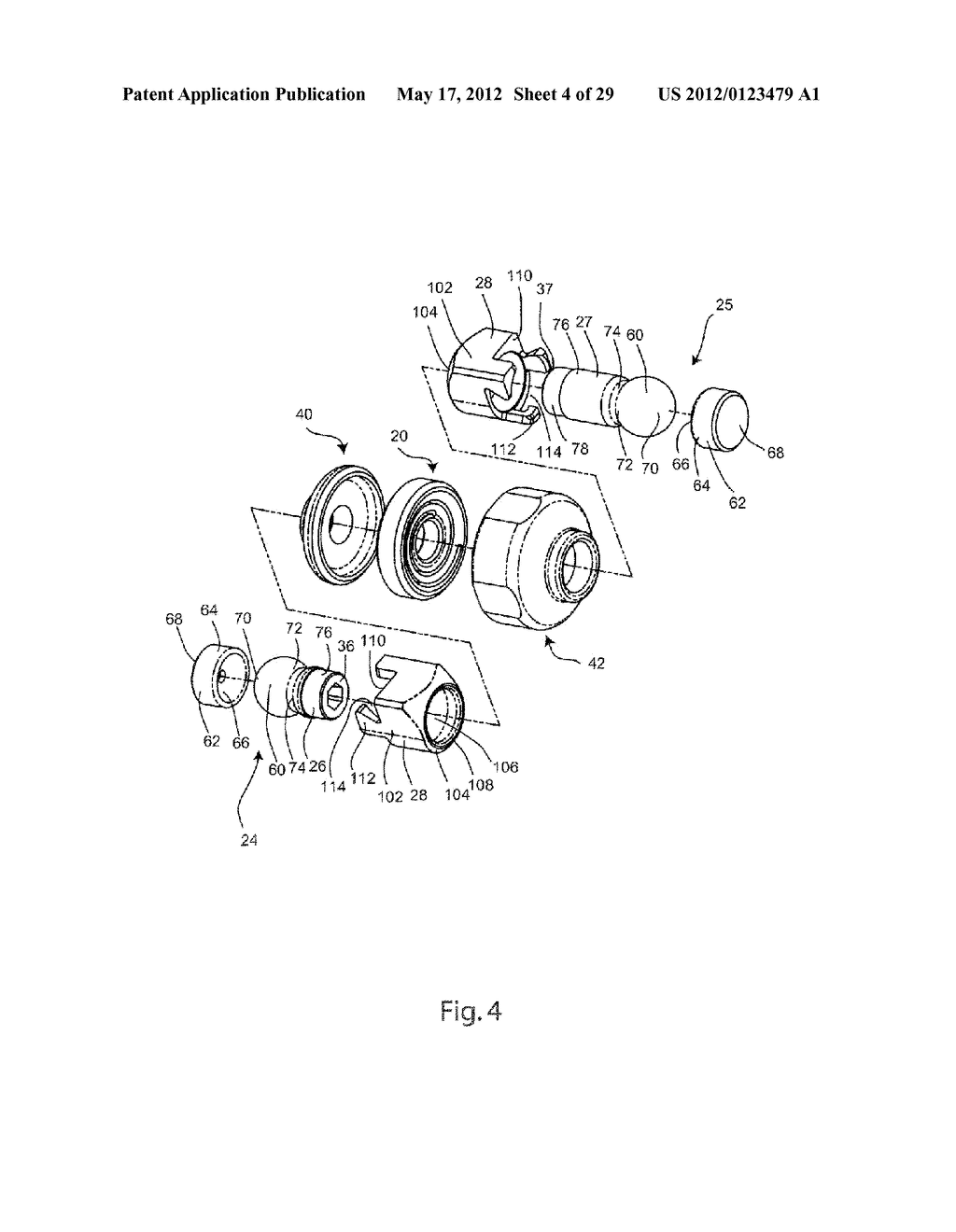 SYSTEM AND METHOD FOR DYNAMIC VERTEBRAL STABILIZATION - diagram, schematic, and image 05