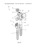 SYSTEM AND METHOD FOR DYNAMIC VERTEBRAL STABILIZATION diagram and image