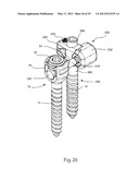 SYSTEM AND METHOD FOR DYNAMIC VERTEBRAL STABILIZATION diagram and image