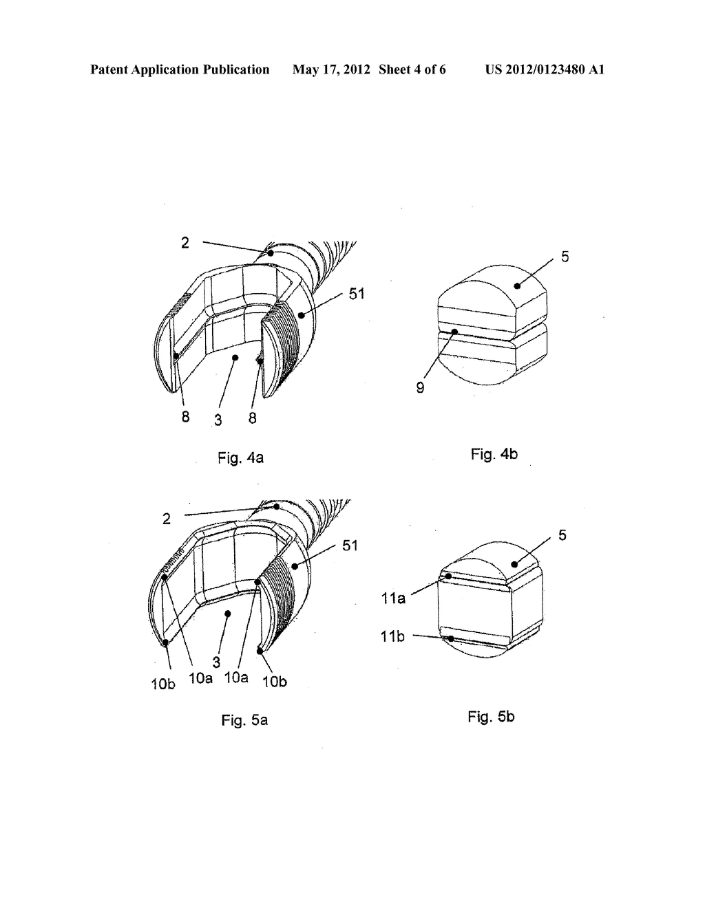 ANCHORAGE ARRANGEMENT FOR A CONNECTING ROD FOR THE STABILIZATION OF THE     SPINE - diagram, schematic, and image 05