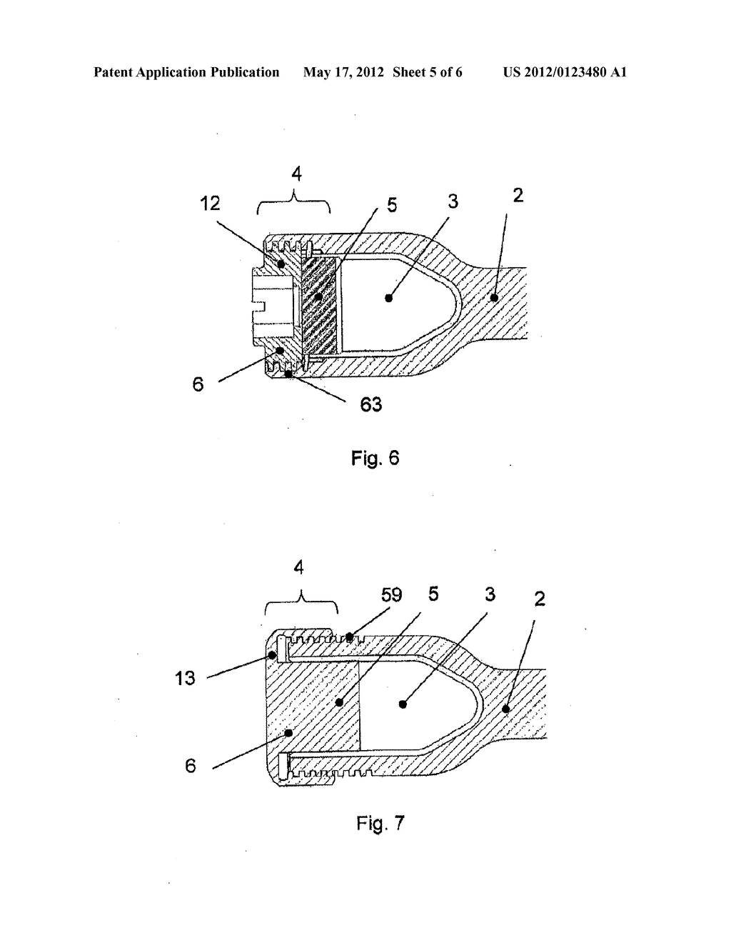 ANCHORAGE ARRANGEMENT FOR A CONNECTING ROD FOR THE STABILIZATION OF THE     SPINE - diagram, schematic, and image 06