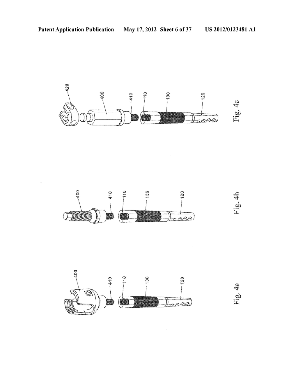 BONE FIXATION DEVICE - diagram, schematic, and image 07