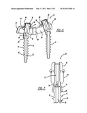 METHOD FOR PLACEMENT OF A PEDICLE SCREW AND ROD SYSTEM diagram and image