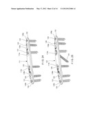 Ulna Osteotomy System diagram and image