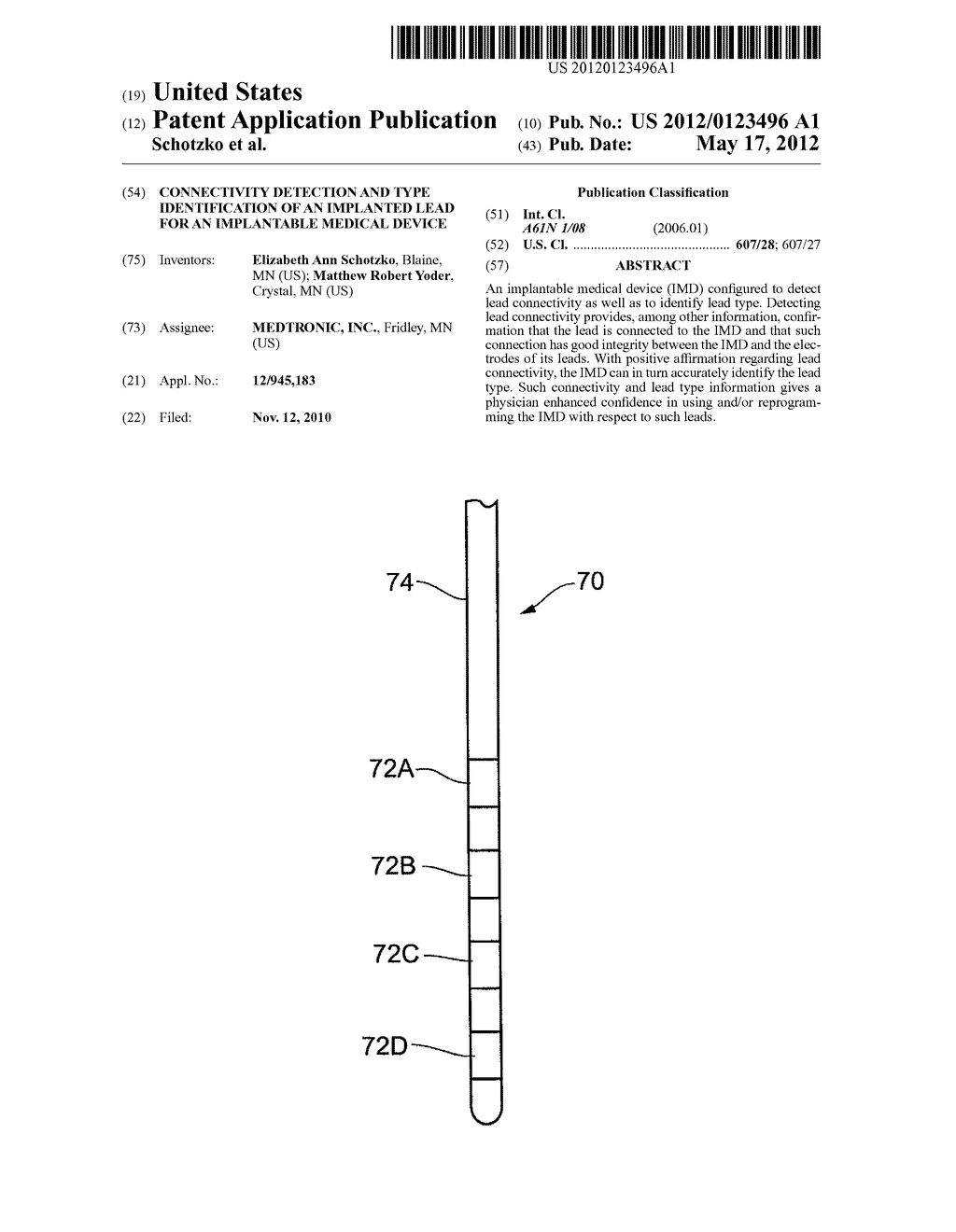 CONNECTIVITY DETECTION AND TYPE IDENTIFICATION OF AN IMPLANTED LEAD FOR AN     IMPLANTABLE MEDICAL DEVICE - diagram, schematic, and image 01