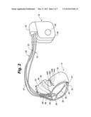 CONNECTIVITY DETECTION AND TYPE IDENTIFICATION OF AN IMPLANTED LEAD FOR AN     IMPLANTABLE MEDICAL DEVICE diagram and image