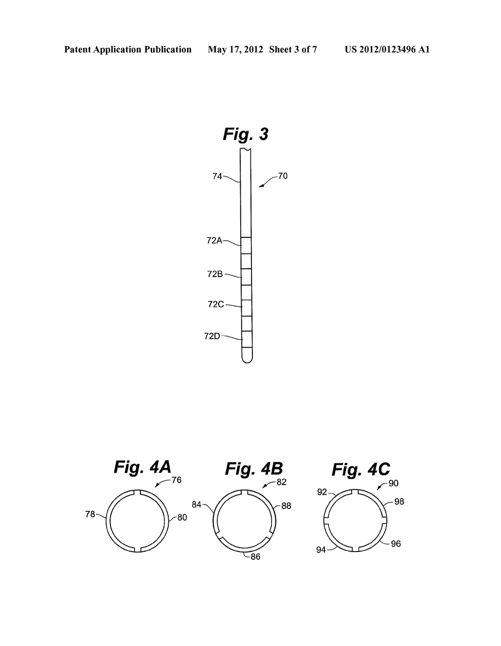 CONNECTIVITY DETECTION AND TYPE IDENTIFICATION OF AN IMPLANTED LEAD FOR AN     IMPLANTABLE MEDICAL DEVICE - diagram, schematic, and image 04