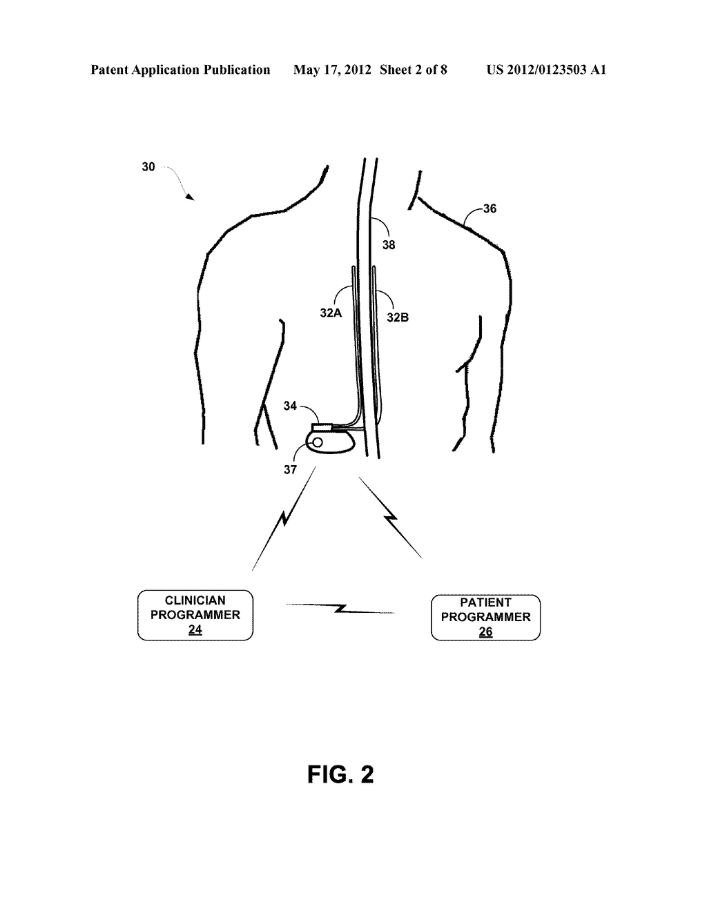 PATIENT PROGRAMMER WITH CUSTOMIZABLE PROGRAMMING - diagram, schematic, and image 03